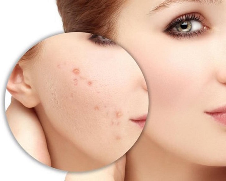 Bạn đã biết đến tác dụng làm đẹp của tinh dầu bưởi đối với làn da của bạn hay không?  